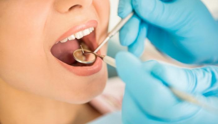 Frequently Asked Questions about Dental Infection