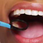 Dental Services That Your Teeth May Need