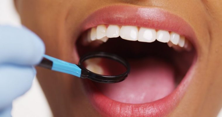 Dental Services That Your Teeth May Need