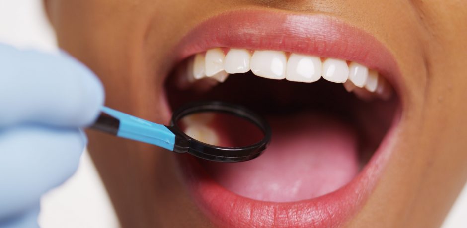 Dental Services That Your Teeth May Need